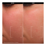Hydrate Balmy Rich Cream - Image 2
