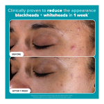 Skin Perfecting 2% BHA Exfoliating Pads - Image 2