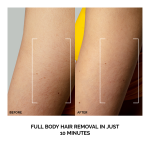 Peach™ 2 IPL Hair Removal Device - Image 2