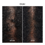 Anti Dandruff Shampoo - Image 2