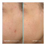 Facial Radiance Pads With Glycolic + Lactic Acids - Image 2
