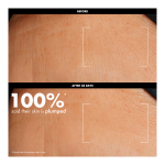 Hydrate Dewy Bubble Serum - Image 3