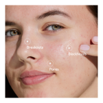 Anti-Blemish Duo - Image 3