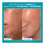 Skin Perfecting 2% BHA Exfoliating Pads - Image 3