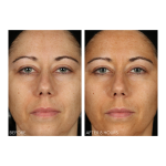Alpha Beta® Glow Pad Self Tanner For Face - Image 3