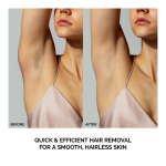 Peach™ 2 IPL Hair Removal Device - Image 3