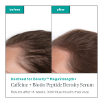 Destined For Density™ Megastrength+ Caffeine + Biotin Peptide Density Serum - Image 3