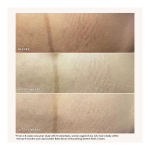 Nourishing Stretch Mark Cream - Image 3