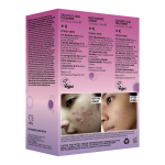 Breakout 101 Set (Limited Edition) - Image 5