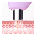 Kiwi™ Derma Tip Large - Image 4