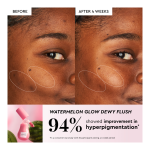 Hue Tinis Mini-Sized Tinted Skincare Routine Set - Image 4