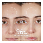 Anti-Blemish Duo - Image 5