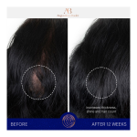 The Scalp Treatment - Image 5