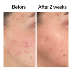 360° Skin Clearing Serum - Image 5