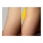 Peach™ 2 Go IPL Hair Removal Device Peach - Image 5