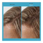 Scalp Care Revitalizing Treatment - Image 5