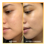Daily Dose Vitamin C + SPF40 Serum - Image 3