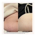 Nourishing Stretch Mark Cream - Image 5