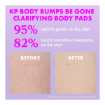 Body Bumps Be Gone Clarifying Body Pads - Image 5