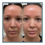 Vitamin B Serum With 5% Niacinamide - Image 5
