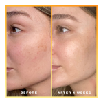 Daily Dose Vitamin C + SPF40 Serum - Image 4